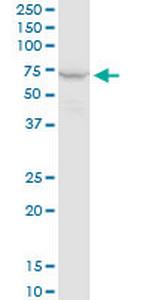 PPP2R1A Antibody in Western Blot (WB)