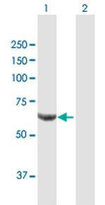 PPP2R1B Antibody in Western Blot (WB)