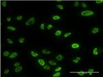 PPP3CA Antibody in Immunocytochemistry (ICC/IF)