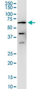 PPP3CA Antibody in Western Blot (WB)