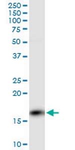 PPP3R1 Antibody in Western Blot (WB)