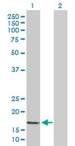 PPP3R2 Antibody in Western Blot (WB)