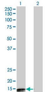 PPP3R2 Antibody in Western Blot (WB)