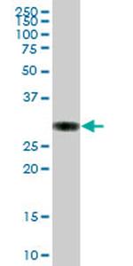 PPT1 Antibody in Western Blot (WB)