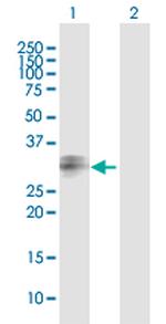 PPT1 Antibody in Western Blot (WB)