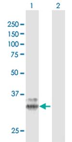 PPT1 Antibody in Western Blot (WB)