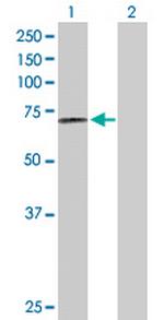 PRCP Antibody in Western Blot (WB)