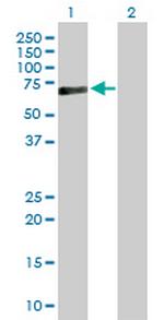 PRF1 Antibody in Western Blot (WB)