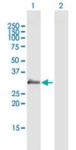 PRG2 Antibody in Western Blot (WB)