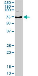 PRKAA1 Antibody in Western Blot (WB)