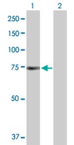 PRKAA1 Antibody in Western Blot (WB)