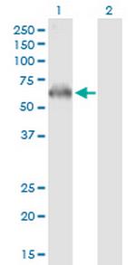 PRKAA2 Antibody in Western Blot (WB)