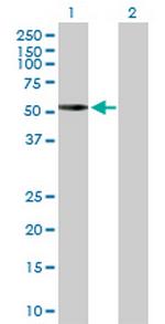 PRKACA Antibody in Western Blot (WB)