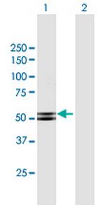 PRKAR2B Antibody in Western Blot (WB)