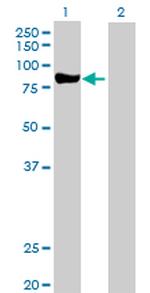 PRKCD Antibody in Western Blot (WB)