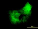 PRKCD Antibody in Immunocytochemistry (ICC/IF)