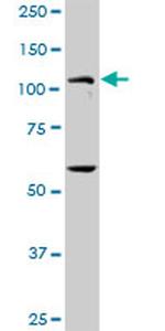 PKN1 Antibody in Western Blot (WB)