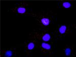 MAPK3 Antibody in Proximity Ligation Assay (PLA) (PLA)