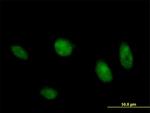 MAPK8 Antibody in Immunocytochemistry (ICC/IF)