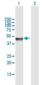 MAPK8 Antibody in Western Blot (WB)