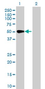 MAPK8 Antibody in Western Blot (WB)