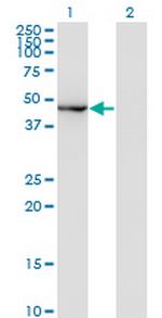 MAPK8 Antibody in Western Blot (WB)