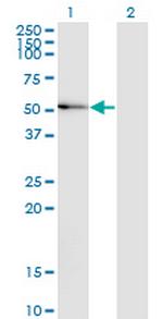 MAPK8 Antibody in Western Blot (WB)