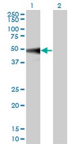 MAPK9 Antibody in Western Blot (WB)