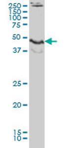 MAPK9 Antibody in Western Blot (WB)