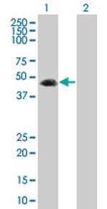 MAP2K5 Antibody in Western Blot (WB)