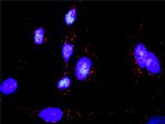 MAP2K6 Antibody in Proximity Ligation Assay (PLA) (PLA)