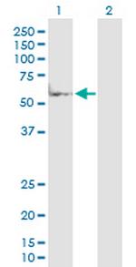 MAP2K7 Antibody in Western Blot (WB)