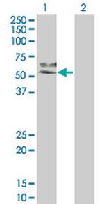 MAP2K7 Antibody in Western Blot (WB)