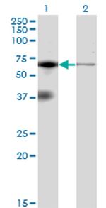 EIF2AK2 Antibody in Western Blot (WB)