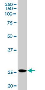 PRL Antibody in Western Blot (WB)