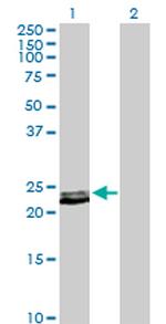 PRL Antibody in Western Blot (WB)