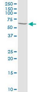 PRLR Antibody in Western Blot (WB)