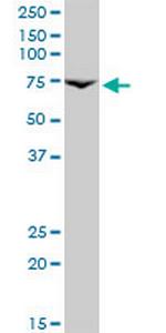 PRLR Antibody in Western Blot (WB)