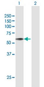 PROC Antibody in Western Blot (WB)