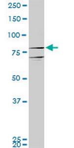 PROX1 Antibody in Western Blot (WB)