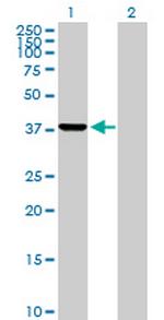 PRPSAP2 Antibody in Western Blot (WB)