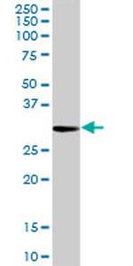 PRTN3 Antibody in Western Blot (WB)