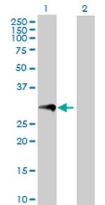 PRTN3 Antibody in Western Blot (WB)