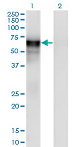 PSAP Antibody in Western Blot (WB)