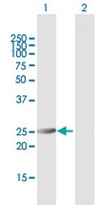 PSMA6 Antibody in Western Blot (WB)