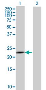 PSMA7 Antibody in Western Blot (WB)