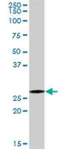 PSMA7 Antibody in Western Blot (WB)