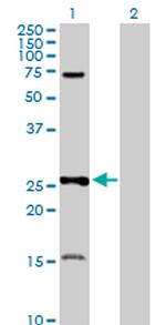 PSMA7 Antibody in Western Blot (WB)