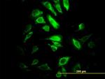 PSMB10 Antibody in Immunocytochemistry (ICC/IF)