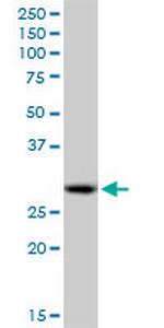 PSME1 Antibody in Western Blot (WB)